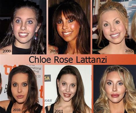 chloe lattanzi age|chloe lattanzi before and after.